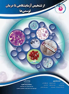 از تشخیص آزمایشگاهی تا درمان لوسمی ها